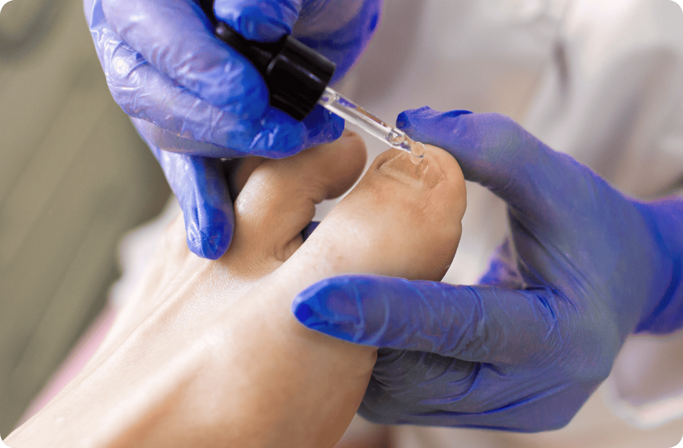 hongos-papilomas https://xn--policlnicaveca-5lb.es/wp-content/uploads/2026/03/hongos-papilomas.png