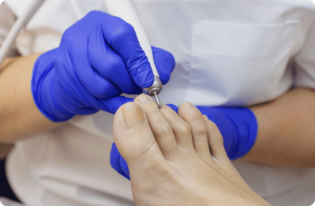 podologia-diabeticos podologia-diabeticos