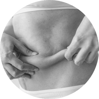 reducir-grasa https://xn--policlnicaveca-5lb.es/wp-content/uploads/2026/03/reducir-grasa-320x320.png