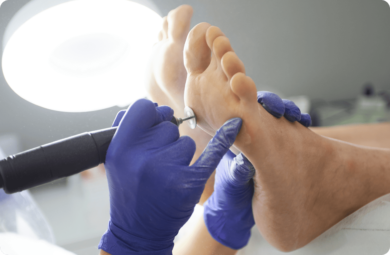 tratamiento-durezas tratamiento-durezas